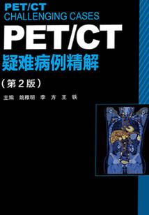 白鬼瞳